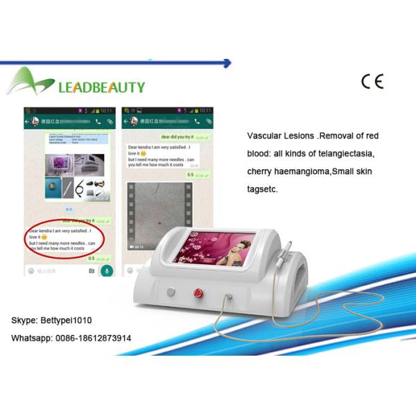 Hot sale 30mhz high frequency spider vein removal / rbs vascular / spider vein removal