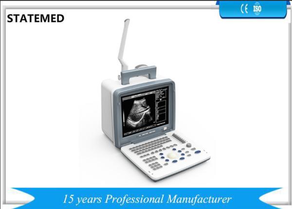 Clear Images Portable Ultrasound Scanner Machine For Hospital Easy Operation
