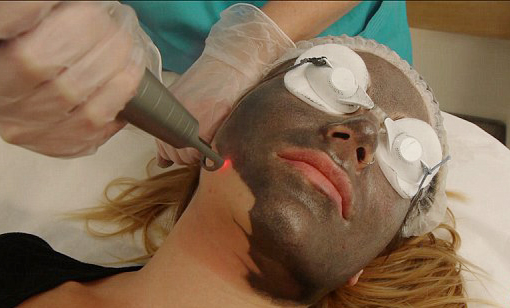 Mini Pico Laser Portable Laser Tattoo Removal Machine With Ce Approved