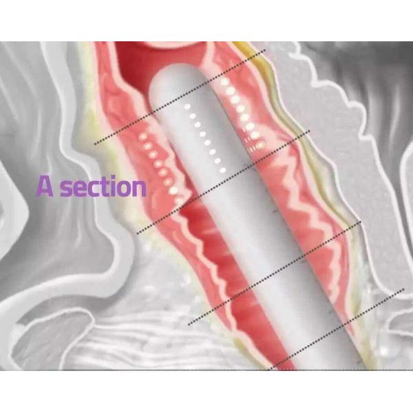 Ultrasonic 2 In 1 HIFU Machine For Women Tightening Rejuvenation