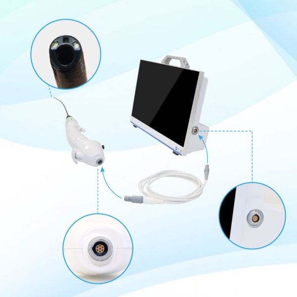 TUYOU 13.3-Inch FHD Flexible Endoscope Camera System Multi-Color OEM Custom All-in-One Portable Uro-Gyn TikTok Hit