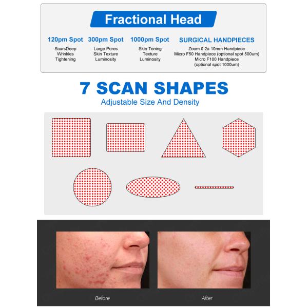 BV13 Portable Co2 Fractional Laser 60W Co2 Fraccionado Laser Vaginal Tightening Co2 Laser Machine For Skin