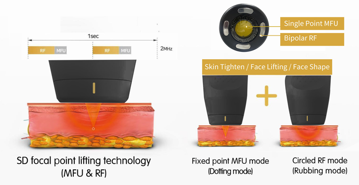 Système de technologie MFU+RF Appareil de beauté HIFU pour le raffermissement de la peau OEM ODM