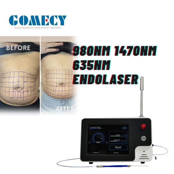 Portable Desktop Endolaser Machine 980nm 1470nm Diode Lasers for Skin Tightening Face Lifting Liposuction Lipolysis
