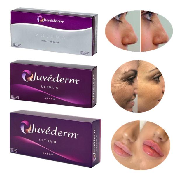 Juvederm 8-12 meses de producto inyectable revolucionario ácido hialurónico del llenador cutáneo