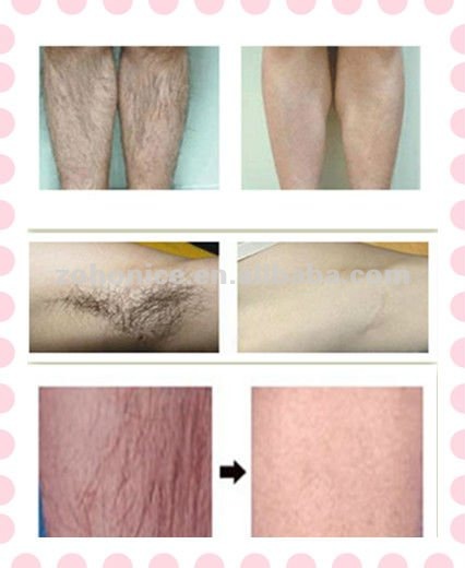 Машина удаления волос лазера диода 808нм безопасной и быстрой обработки самая новая