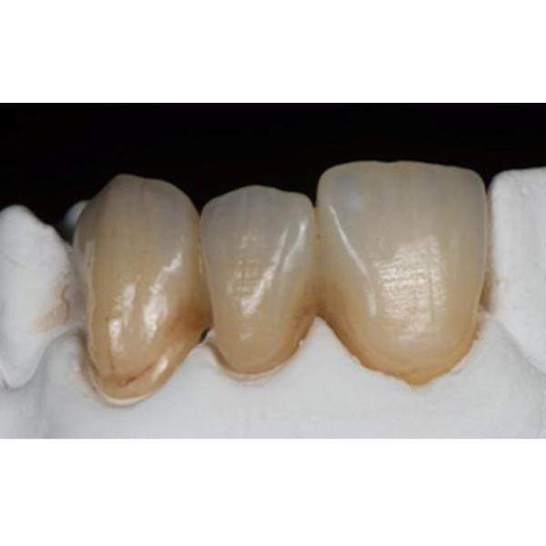 Блоков Mpa диска Zirconia 49% UT разнослоистые ультра просвечивающие 600 зубоврачебных керамических