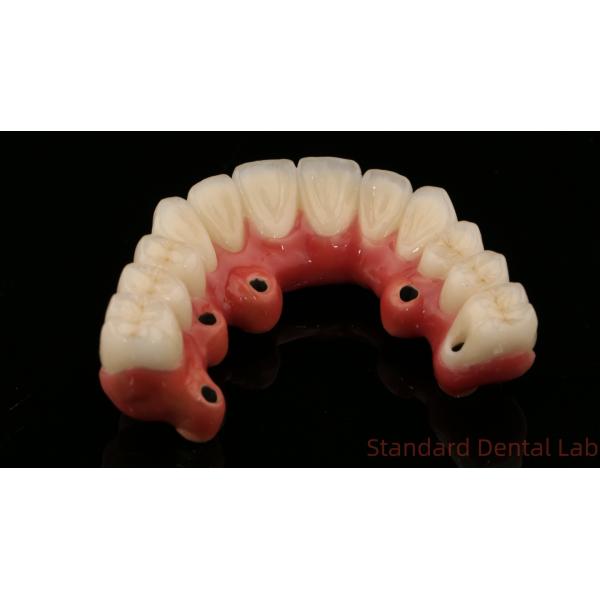 Full Arch Zirconia Implants Bridge Zirconia Crown Vita Shade Customized All On Four / Six Dental Implant