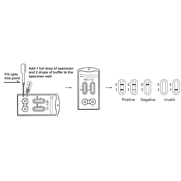 Наборы легкой рождаемости дома деятельности испытывая, набор теста ХСВ домой для ХСВ ИгГ/ИгМ комбинированного
