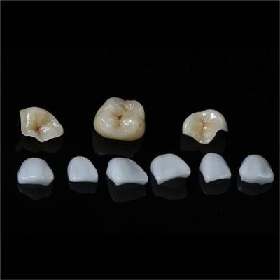 Tooth All Porcelain IPS Emax Inlay Onlay Veneer Aesthetic In Dentistry
