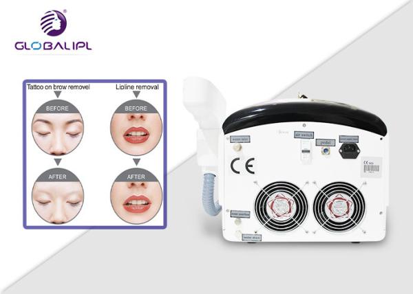 Portable Colorful Tattoo Removal Beauty Laser Machine Polular in Salon