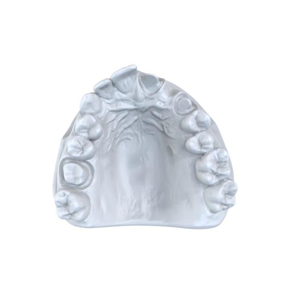 Tipo de reparação Modelagem Resina Dental 1kg / garrafa