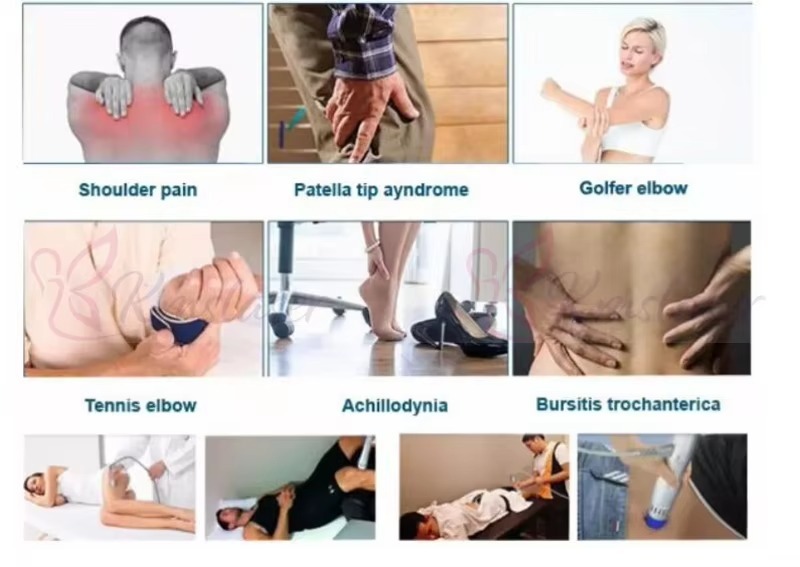 Portable Non Invasive Electromagnetic ESWT Rehabilitation Focused Shockwave Therapy Machine