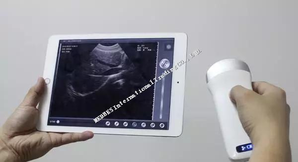 Apple IPAD mini/IPAD air/IPHONE,Android PhonesWireless Ultrasound Scanner