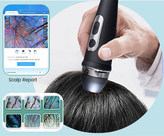 AI Skin Analyzer System With 11 Spectral Imaging Scalp Analysis