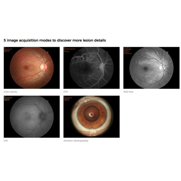 Камера Fundus FFA FAF цифров не Mydriatic отсутствие фотографии красного света Anterior