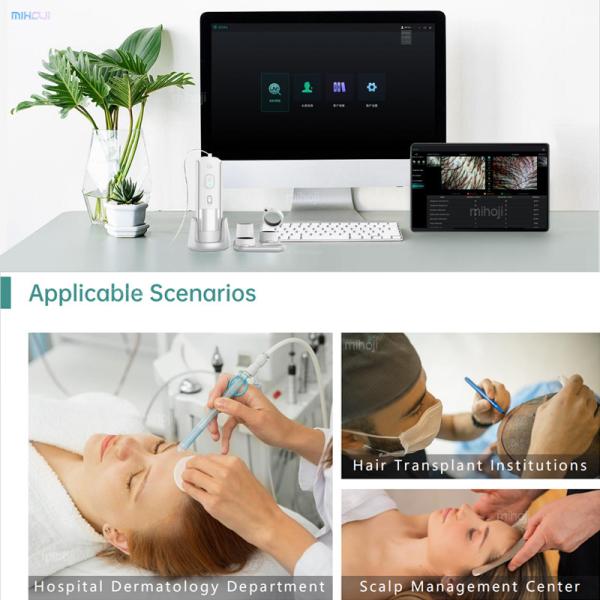 16 Million HD Lenses Skin Hair Analyzer Machine For Head Revitalization