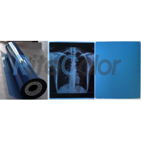 Толщина фильма 210ум медицинского отображения кс Рэй радиологии голубая для принтера Эпсон струйного
