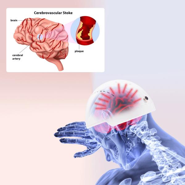 Medical Brain Rehabilition Infrared Transcrial Neuron Injury Physiotherapy Helmet For Depression Treat