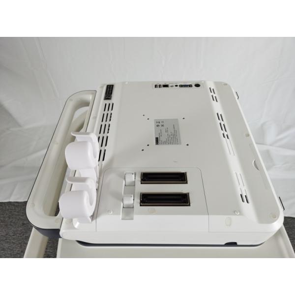 Hospital Outside 2020 New Portable Digital 15 Inch Color Doppler Ultrasound Machine
