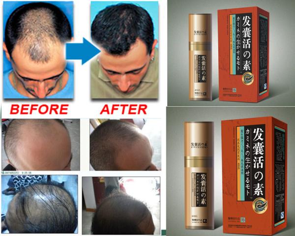 hair treatment Hair Growth Essence anti hair Loss Liquid dense unix hair conditioner Serum