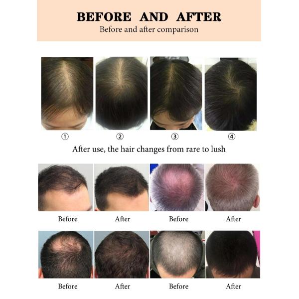 5W Home 660NM Hair Growth Massage Comb