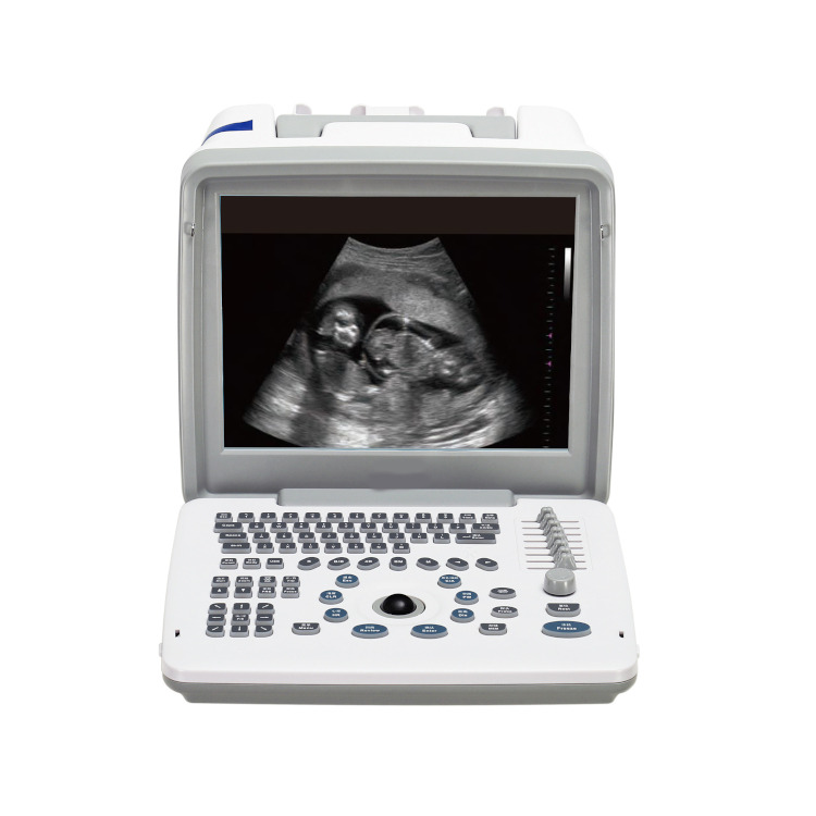 PC Based Metal Machine&laptop Machine Scanner 3d 12 Display Led Portable Ultrasound Doppler Color