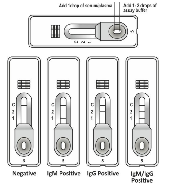 Reliable Typhiod Bacterial Infection Blood Test  Medical Diagnostic Highly Accurate