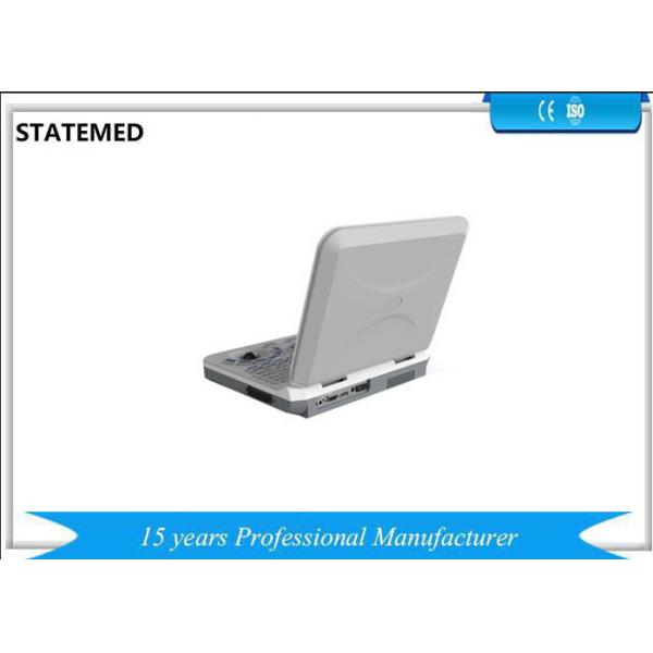 Medical Multi Language Portable Ultrasound Scanner Pregnancy Test Ultrasound