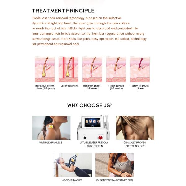 120 J/CM 600w Diode Laser Hair Removal Ladies Salon Ipl Machine