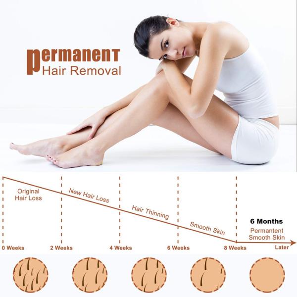 1000Mj лазер диода машины 755nm 808nm 1064nm корки углерода лазера ND YAG