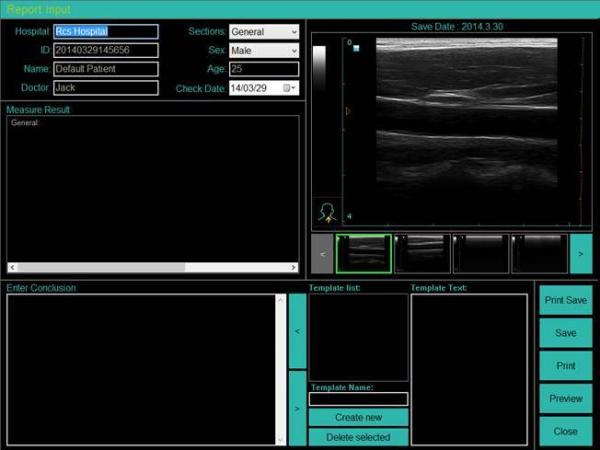 High Resolution  Laptop B/W Ultrasound MSK  Ultrasound Scanner  Laptop Ultrasound Machine