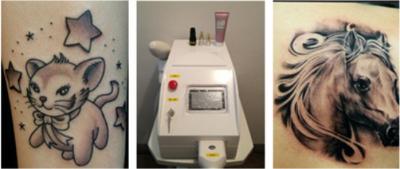 Portable and mini salon home use CE approved q switched nd yag laser 2000mj
