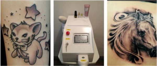 Portable and mini salon home use CE approved q switched nd yag laser 2000mj