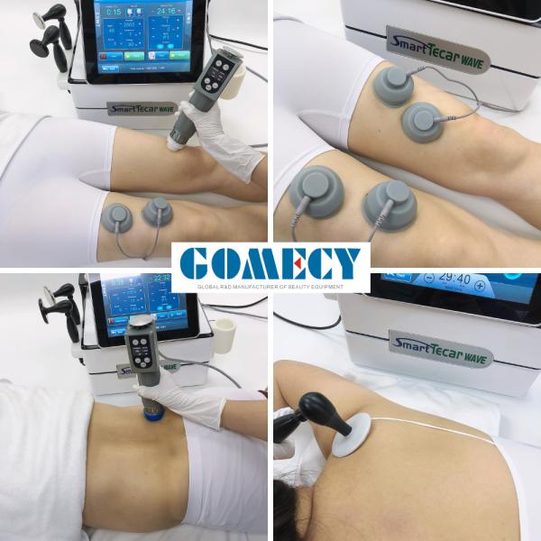 448K Smart TECAR Monopolar Radiofrecuencia CET RET RF Máquina Tecar para fisioterapia y recuperación