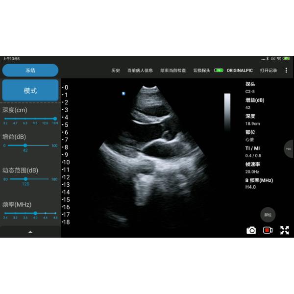 5MHz Pocket Handheld Ultrasound Scanner For Mobile Cardiac Diagnosis