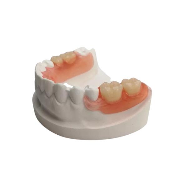 Крона реалистического Zirconia формы зубоврачебная изготовляя модель Denture 3D