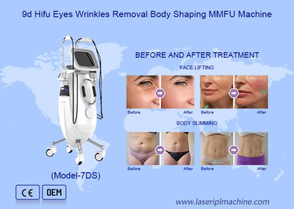 Máquina de emagrecimento não cirúrgico 9D HIFU de remoção de gordura Rejuvenescimento da pele