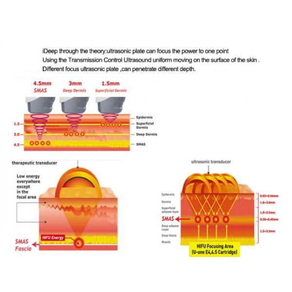 Vertical HIFU Multifunctional Beauty Machine Face Lifting Anti Puffiness