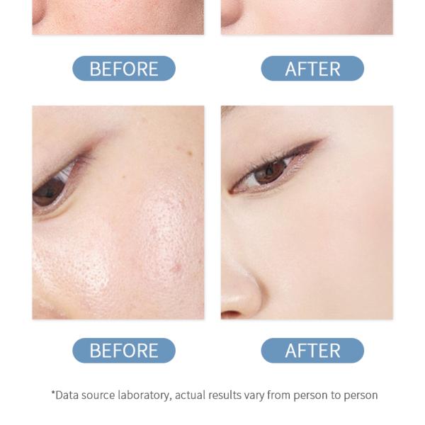 Loción Corporal Blanqueadora para el Cuidado de la Piel, Elimina Manchas Oscuras y Amarillentas