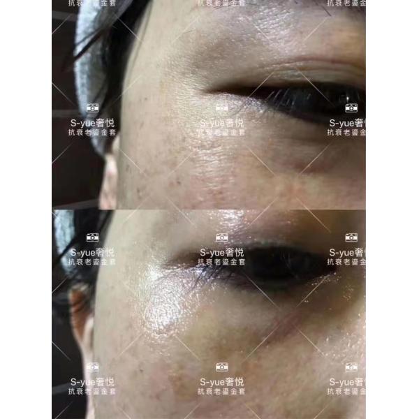S-yue brand golden rejuvenating tightening series anti aging skin firming cosmetics