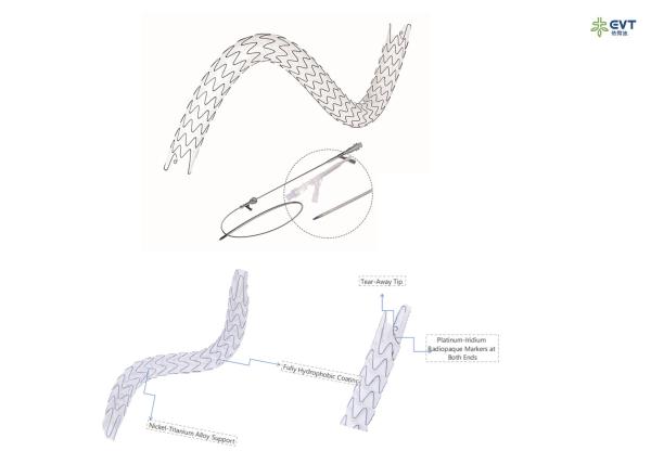 Maximized Lumen URS Stent With Hydrophobic Nitinol Technology Anti Embedding Coating