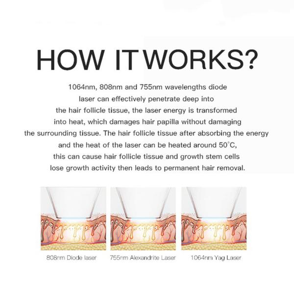 Магнитооптическая белизна машины 400W удаления волос лазера диода 755nm