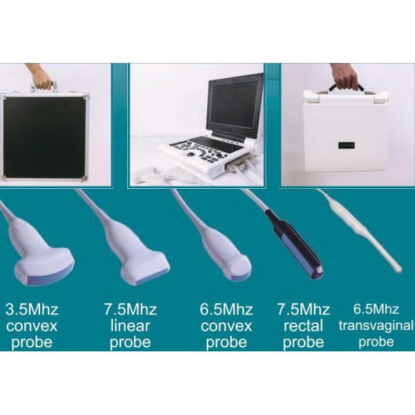 Ультразвук Доплера в частоте 12МХз зонда ультразвука Доплера дома беременности