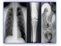 Filme holográfico da imagem latente médica, filme do ANIMAL DE ESTIMAÇÃO X Ray das impressoras térmicas