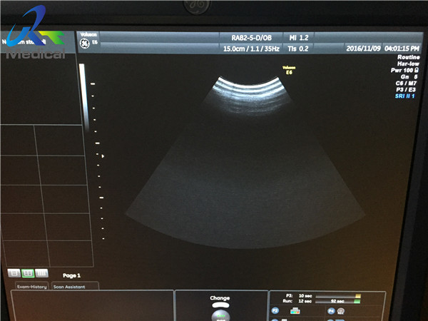 GE RAB2-5-D banda ancha con convertidor de matriz curva convexa / ultrasonido digital