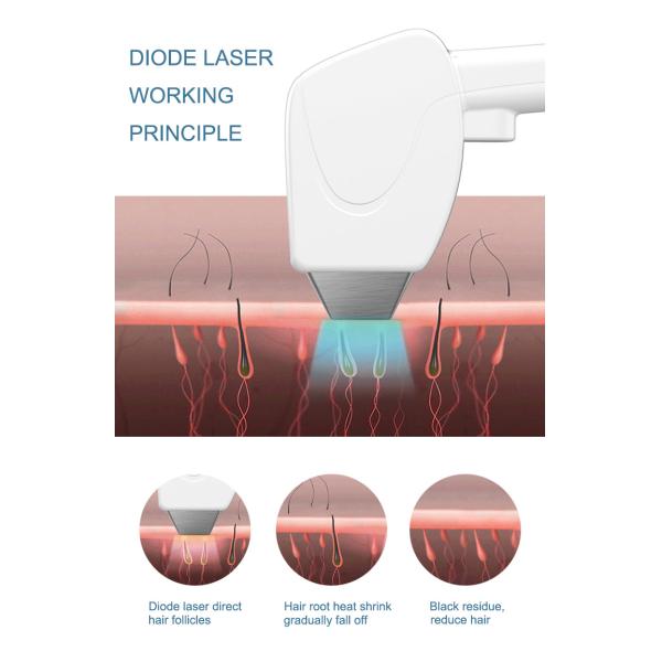 Manufacture Diode Laser Hair Removal Machine OEM Logo 810 Laser Hair Removal