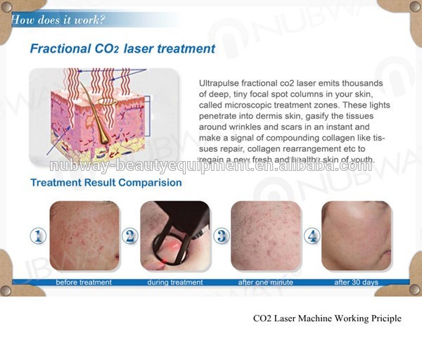 Bottom factory price!!! High quality rf skin rejuvenation vaginal tightening medical fractional co2 laser equipment