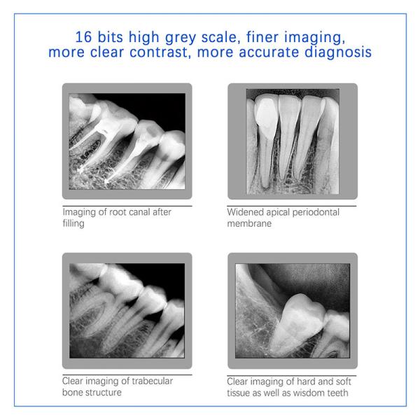 Dental X-Ray Digital Sensor For Dental Implant And Endodontic Treatment