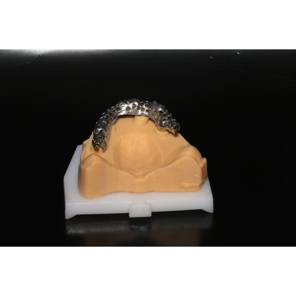 Gigital Dental Laboratory | Class 5 All On 4 AOX Implants With Hybrid Titanium Bar / Clips / Metal Mesh / Full Denture